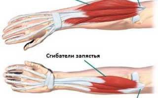 Чем лечить эпикондилит