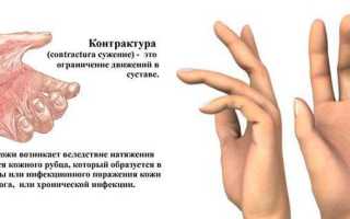 Массаж при артрите