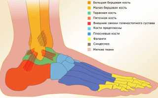 Перелом ноги в голеностопе