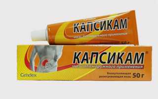 Болят голеностопные суставы