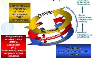 Болезнь остеоартроз