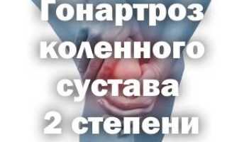 Артроз коленного сустава 2 степени инвалидность